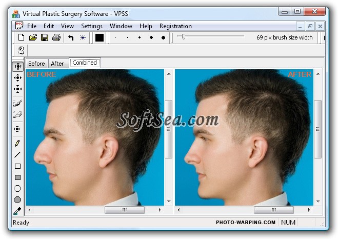 Virtual Plastic Surgery Software - VPSS Screenshot